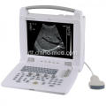 Draagbare Laptop Ultrasound Scanner Ultrasound Machine Prijs
